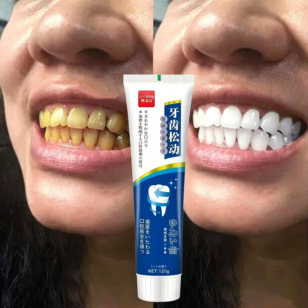 Teeth Whitening Japan - Fix Loose Teeth Japanese Imported Toothpaste