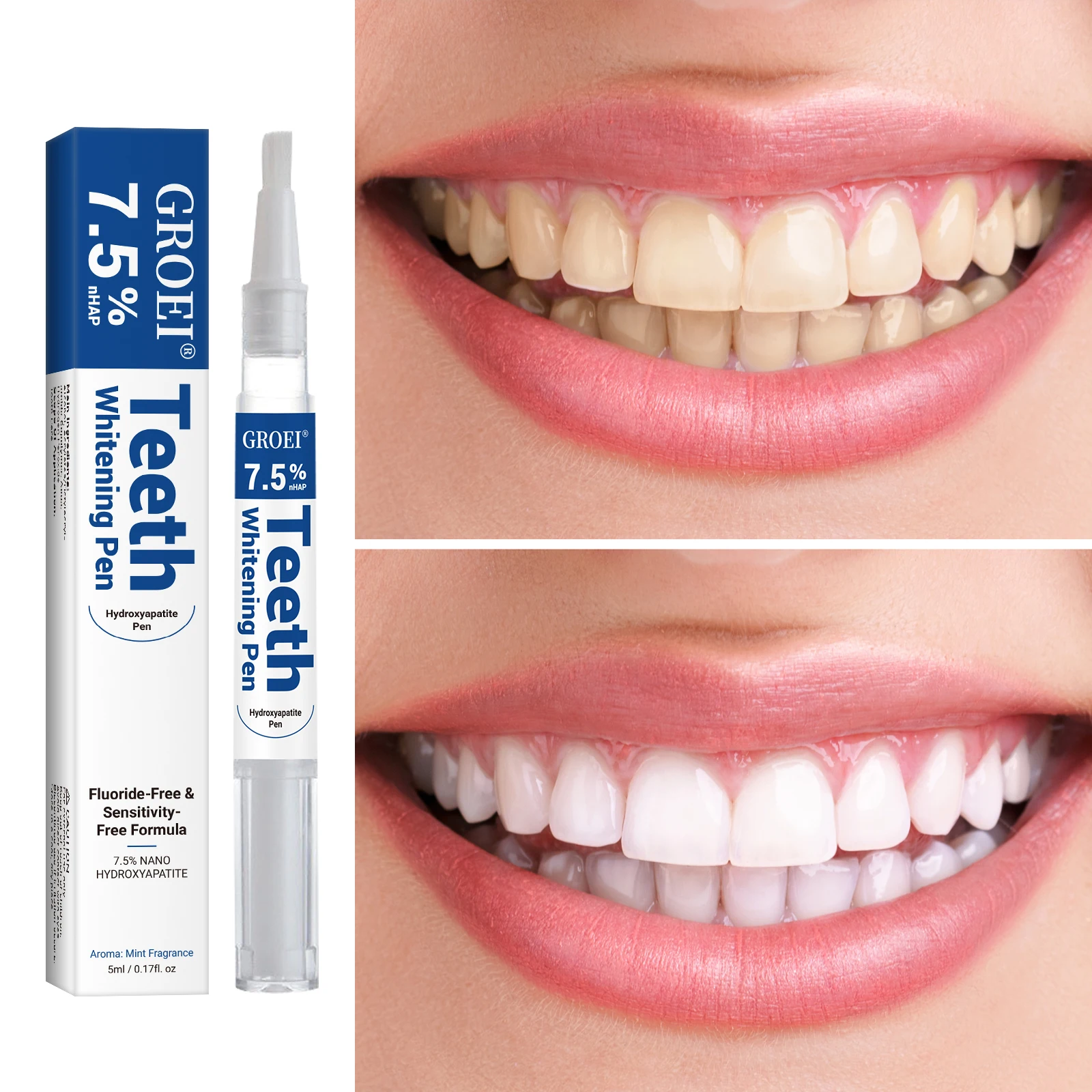 Hydroxyapatite Tooth Whitening - Teeth Whitening With Peroxide review and price