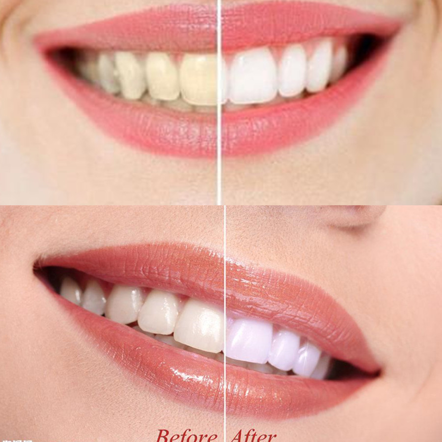 Bamboo Charcoal Teeth Tooth De - Teeth Whitening Ingredients review and price