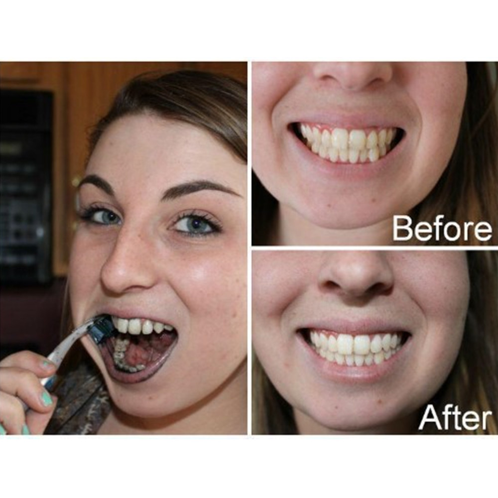 Bamboo Charcoal Teeth Tooth De - Teeth Whitening Ingredients review and price