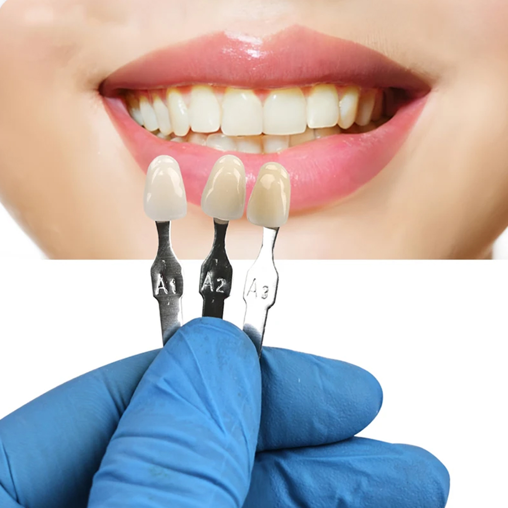 VITA 16 Colors Teeth Shade Gui - Teeth Whitening Shade Guide review and price
