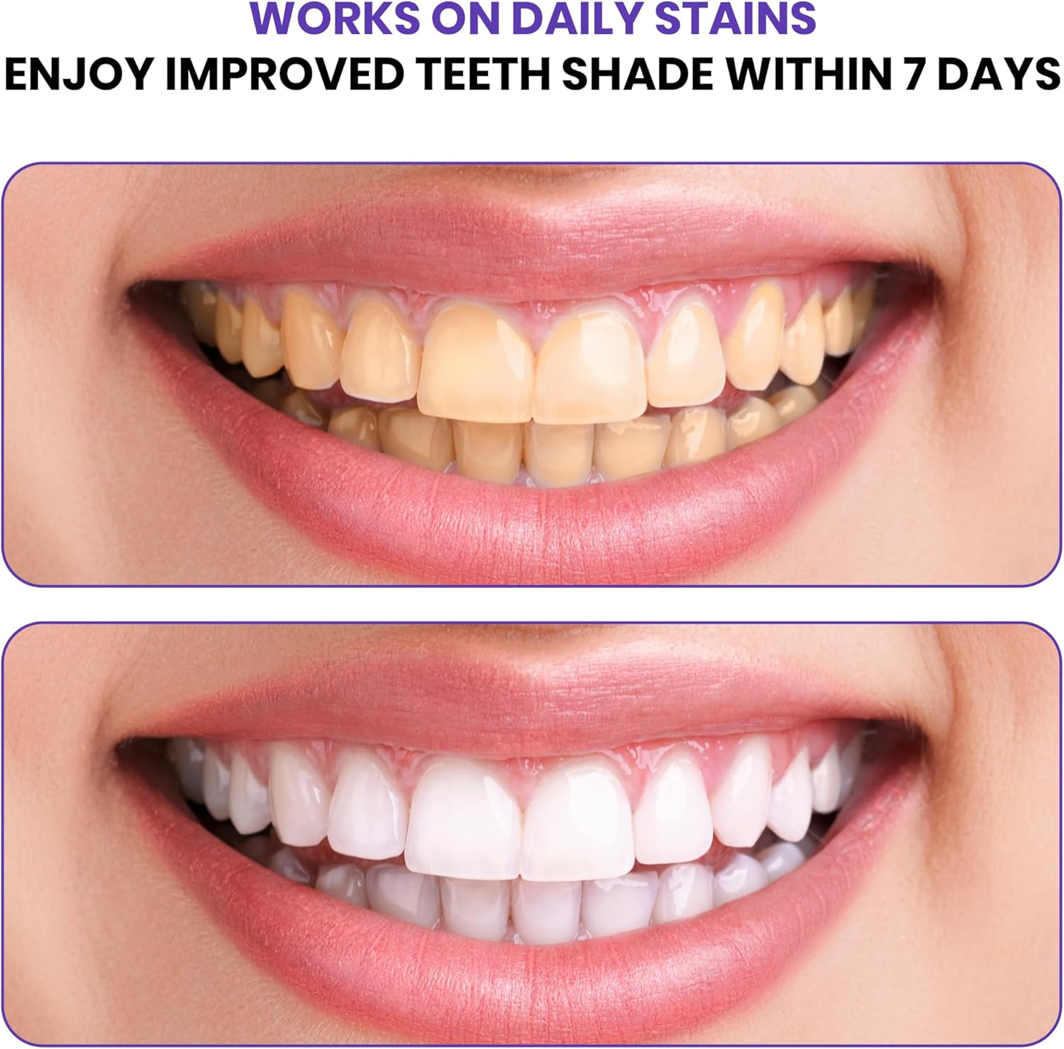 Advanced Purple Teeth Whitenin - Teeth Whitening In Office review and price