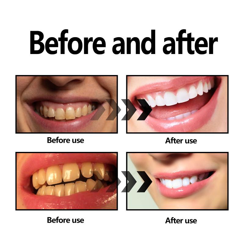 Bamboo Charcoal Powder Teeth N - Teeth Whitening Filter review and price