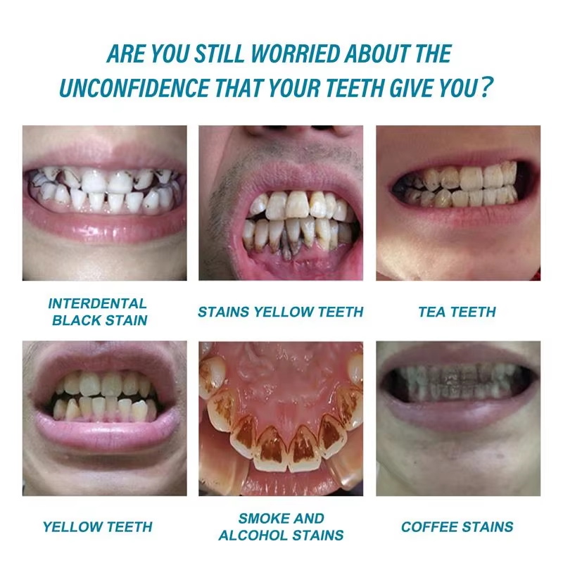 Teeth Whitening Essence Remove - Teeth Whitening Serum review and price