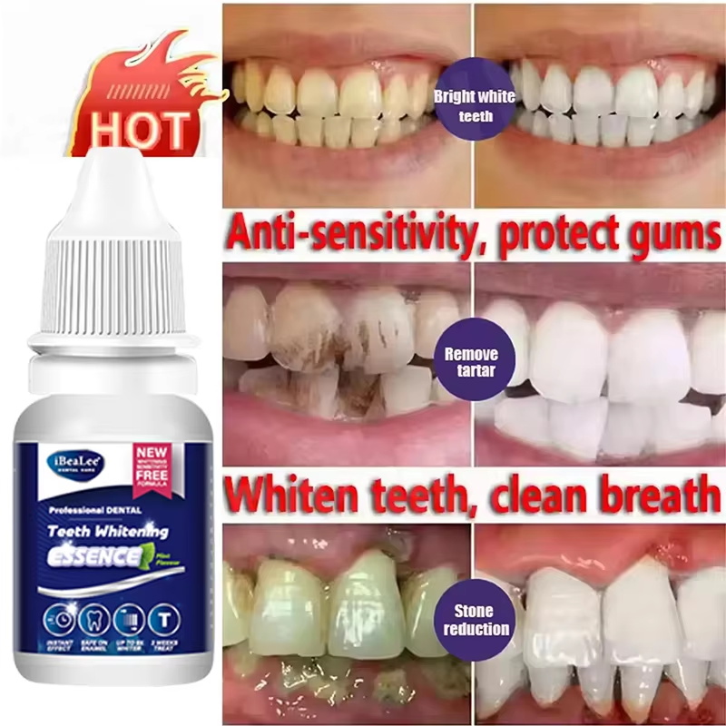 Teeth Whitening Essence Remove - Teeth Whitening Serum review and price