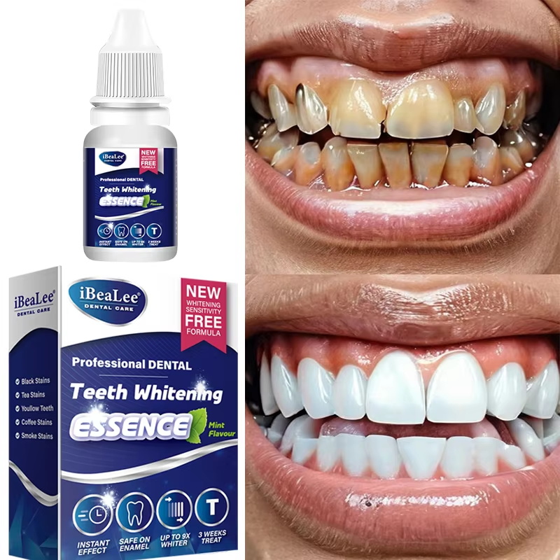 Teeth Whitening Essence Remove - Teeth Whitening Serum review and price
