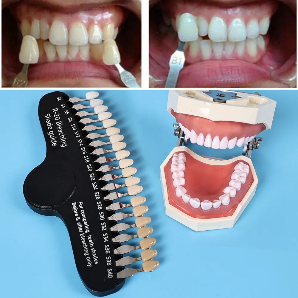ELIJAH R-20 Bleaching Shade Gu - Teeth Whitening Shade Guide review and price