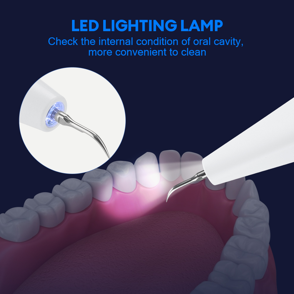Ultrasonic Dental Calculus Rem - Teeth Whitening Strips review and price