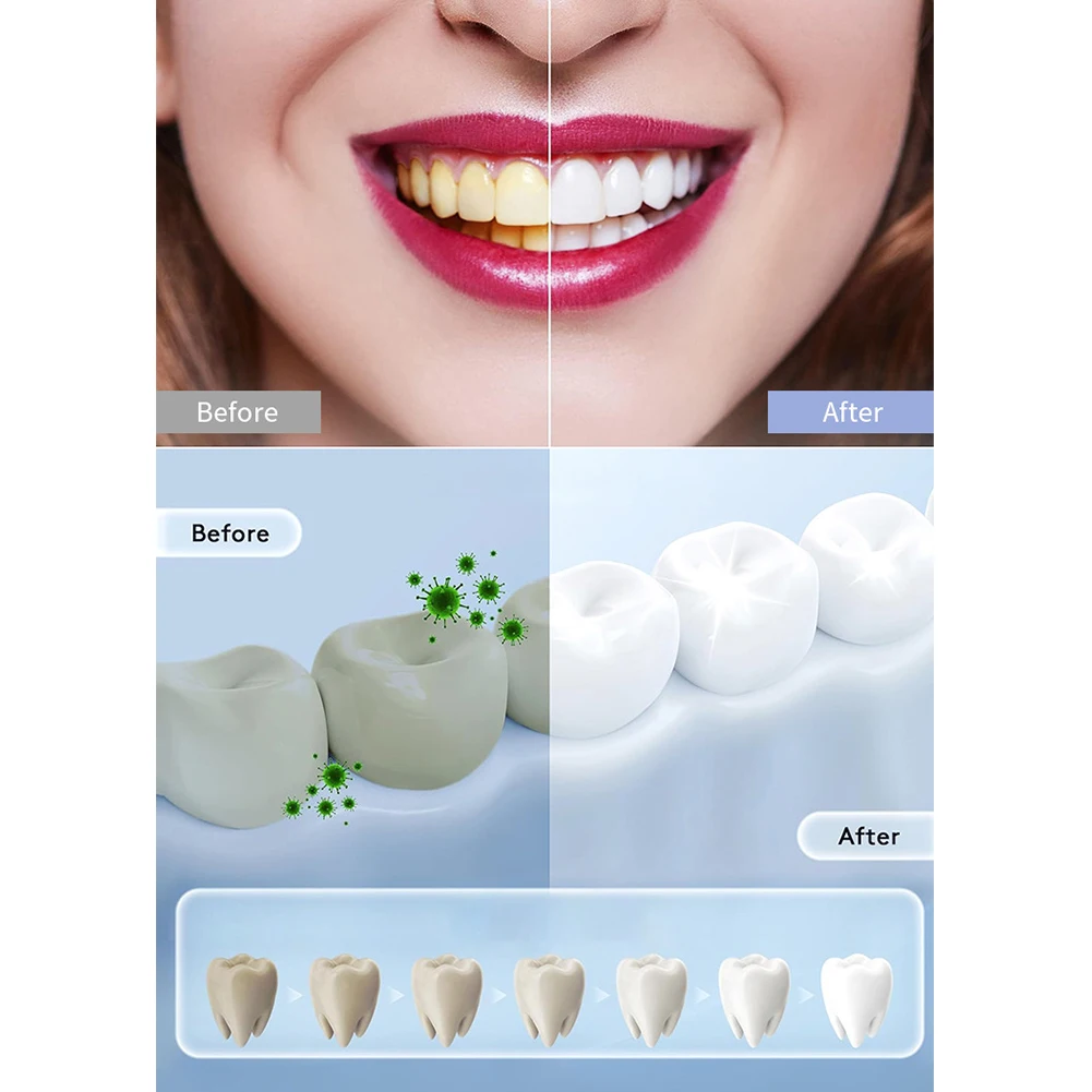 1PC Household Smart LED Teeth  - Teeth Whitening In Office review and price