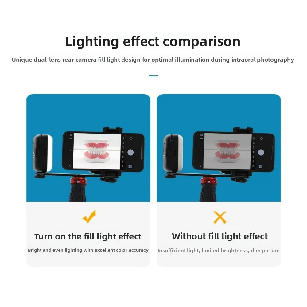 Dental Photography Light, Blue - Teeth Whitening Session review and price