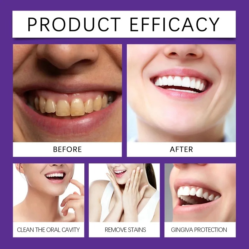 Purple Teeth Restoration Miner - Teeth Whitening Ingredients review and price