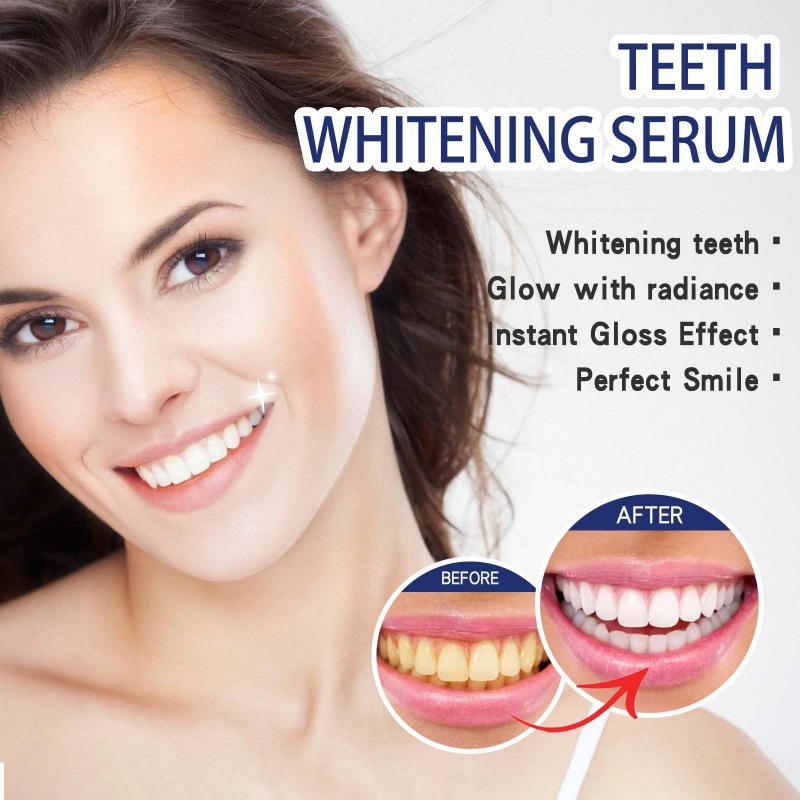 Professional Teeth Brightening - Teeth Whitening Serum review and price